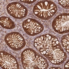 Immunohistochemical staining of human colon shows strong membranous positivity in glandular cells.