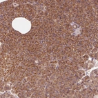 Immunohistochemical staining of human pancreas shows strong membranous positivity in exocrine glandular cells.