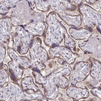 Immunohistochemical staining of human placenta shows strong cytoplasmic granular positivity in trophoblastic cells.