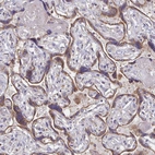 Immunohistochemical staining of human placenta shows strong cytoplasmic granular positivity in trophoblastic cells.