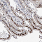 Immunohistochemical staining of human duodenum shows moderate nuclear positivity in glandular cells.
