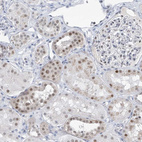 Immunohistochemical staining of human kidney shows moderate nuclear positivity in cells in tubules.
