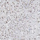 Immunohistochemical staining of human liver shows moderate nuclear positivity in hepatocytes.