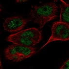 Immunofluorescent staining of human cell line U-251 MG shows localization to nucleoplasm.