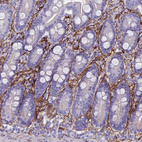 Immunohistochemical staining of human duodenum shows strong membranous positivity in cells in lamina propria.