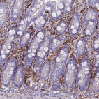 Immunohistochemical staining of human duodenum shows strong membranous positivity in cells in lamina propria.