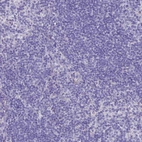 Immunohistochemical staining of human lymph node shows no membranous positivity in non-germinal center cells as expected.