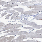 Immunohistochemical staining of human skeletal muscle shows no nuclear positivity in myocytes as expected.