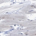 Immunohistochemical staining of human skeletal muscle using Anti-THOC1 antibody HPA019687.