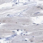 Immunohistochemical staining of human skeletal muscle using Anti-THOC1 antibody HPA019687.