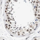 Immunohistochemical staining of human testis using Anti-THOC1 antibody HPA019687.