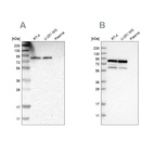 Western blot analysis using Anti-THOC1 antibody HPA019096 (A) shows similar pattern to independent antibody HPA019687 (B).