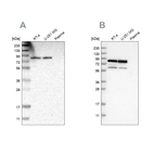 Western blot analysis using Anti-THOC1 antibody HPA019096 (A) shows similar pattern to independent antibody HPA019687 (B).