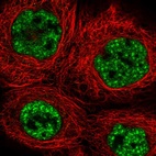 Immunofluorescent staining of human cell line A-431 shows localization to nuclear speckles.