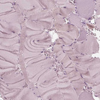 Immunohistochemical staining of human skeletal muscle shows no positivity in myocytes as expected.
