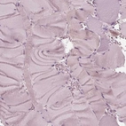 Immunohistochemical staining of human skeletal muscle shows no positivity in myocytes as expected.