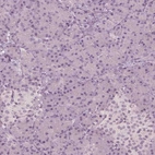 Immunohistochemical staining of human pancreas shows no positivity in exocrine glandular cells as expected.