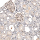 Anti-NCR3LG1 Antibody