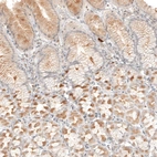 Immunohistochemical staining of human stomach shows weak to moderate membranous and cytoplasmic positivity in glandular cells.