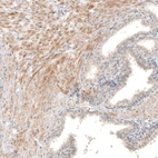 Immunohistochemical staining of human prostate shows weak to moderate cytoplasmic positivity in smooth muscle cells.