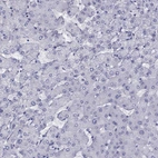 Immunohistochemical staining of human liver shows no positivity in hepatocytes as expected.