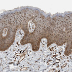 Immunohistochemical staining of human skin shows moderate cytoplasmic positivity in squamous epithelial cells.