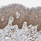 Immunohistochemical staining of human skin shows moderate cytoplasmic positivity in squamous epithelial cells.