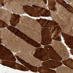 Immunohistochemical staining of human skeletal muscle shows strong cytoplasmic positivity in myocytes.