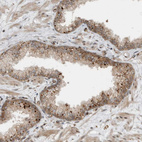 Immunohistochemical staining of human prostate shows moderate cytoplasmic positivity in glandular cells.