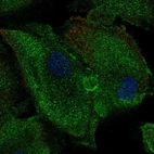 Immunofluorescent staining of human cell line RPTEC TERT1 shows localization to cytosol.