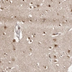 Immunohistochemical staining of human cerebral cortex shows strong nuclear positivity in neurons.