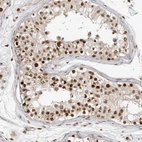 Immunohistochemical staining of human testis shows strong nuclear positivity in cells in seminiferous ducts.