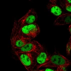 Immunofluorescent staining of human cell line Hep G2 shows localization to nucleoplasm.