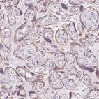 Immunohistochemical staining of human placenta shows moderate cytoplasmic granular positivity in trophoblastic cells.