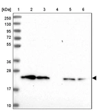 Lane 1: Marker [kDa] 250, 130, 95, 72, 55, 36, 28, 17, 10_br/_Lane 2: Human cell line RT-4_br/_Lane 3: Human cell line U-251MG sp_br/_Lane 4: Human plasma (IgG/HSA depleted)_br/_Lane 5: Human liver tissue_br/_Lane 6: Human tonsil tissue