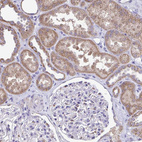 Immunohistochemical staining of human kidney shows moderate cytoplasmic granular positivity in renal tubules.