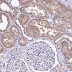 Immunohistochemical staining of human kidney shows moderate cytoplasmic granular positivity in renal tubules.