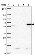 Lane 1: Marker [kDa] 250, 130, 95, 72, 55, 36, 28, 17, 10_br/_Lane 2: Human cell line RT-4_br/_Lane 3: Human cell line U-251MG sp_br/_Lane 4: Human plasma (IgG/HSA depleted)_br/_Lane 5: Human liver tissue