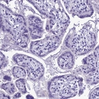 Immunohistochemical staining of human placenta shows no positivity in trophoblastic cells as expected.