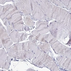 Immunohistochemical staining of human skeletal muscle shows no positivity in myocytes as expected.