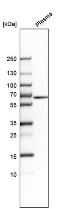 Western blot analysis in human plasma.