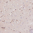 Immunohistochemical staining of human cerebral cortex shows moderate cytoplasmic positivity in endothelial cells and glial cells.