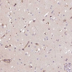 Immunohistochemical staining of human cerebral cortex shows moderate cytoplasmic positivity in endothelial cells and glial cells.