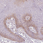 Immunohistochemical staining of human skin shows moderate cytoplasmic positivity in subset of squamous epithelial cells.