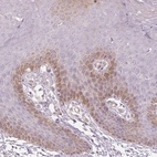 Immunohistochemical staining of human skin shows moderate cytoplasmic positivity in subset of squamous epithelial cells.