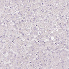 Immunohistochemical staining of human liver shows no positivity in hepatocytes as expected.
