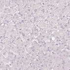 Immunohistochemical staining of human liver shows no positivity in hepatocytes as expected.