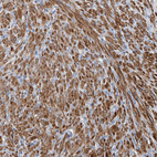 Immunohistochemical staining of human prostate shows strong cytoplasmic positivity in smooth muscle cells.