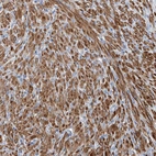 Immunohistochemical staining of human prostate shows strong cytoplasmic positivity in smooth muscle cells.
