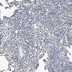 Immunohistochemical staining of human lymph node shows no positivity in non-germinal center cells.